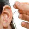 Disaster Trauma And Ear Acupuncture Treatment